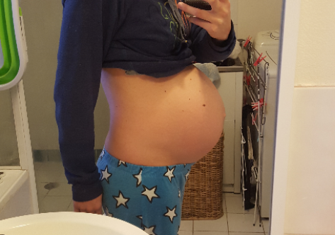 40.1 weeks- The day I gave birth with Miss A